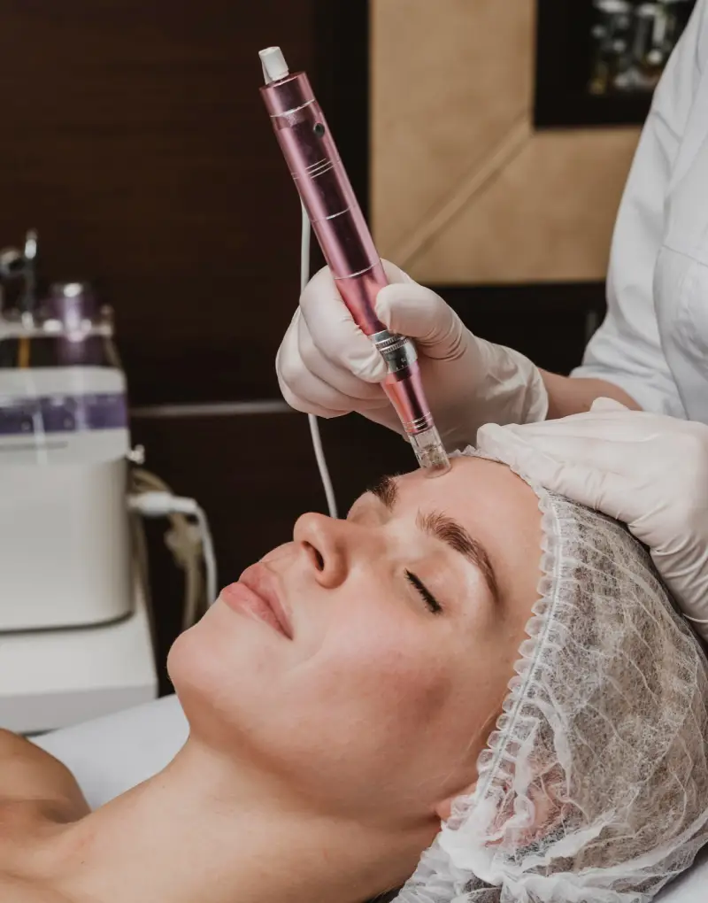 about send webp img A close-up of a hand holding a pink microneedling device while performing a facial treatment, showcasing sterile gloves and a professional setting.
